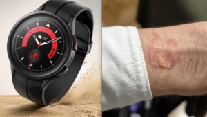 Galaxy Watch 5 Pro Gece Boyunca Aşırı Isınıp Tamamen Boşaldı, Kullanıcının Bileğinde Su Toplanmasına Yol Açtı